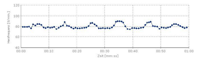 Heart rate regulation after 17 days of using the REGUMED Protector device