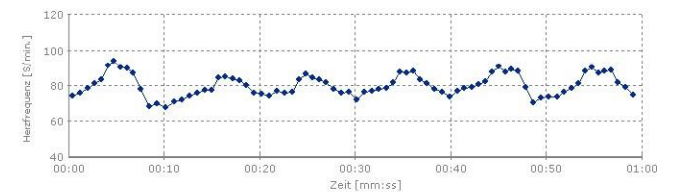 Heart rate regulation after 20 days of using the REGUMED Protector device