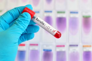 borrelia and lyme disease diagnosis