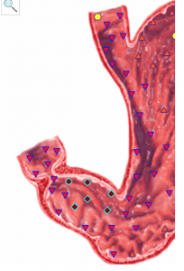 Stressed stomach scan 1