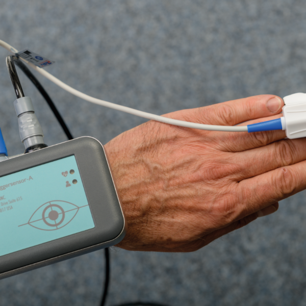 BBC - Triggersensor A
