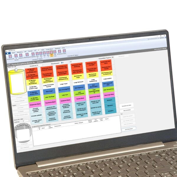 Laptop screen displaying a color-coded grid dashboard in a software application.